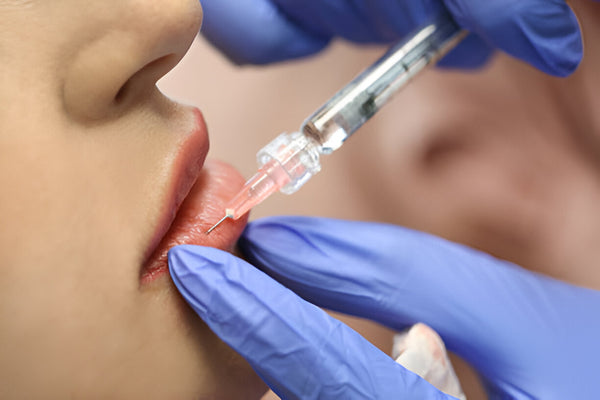 Dermal Fillers