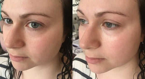 This Tinted Under-eye Cream With SPF