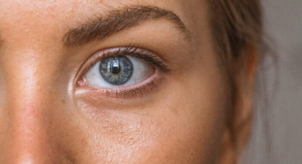 Skin Discoloration: Causes, Prevention, And Treatments