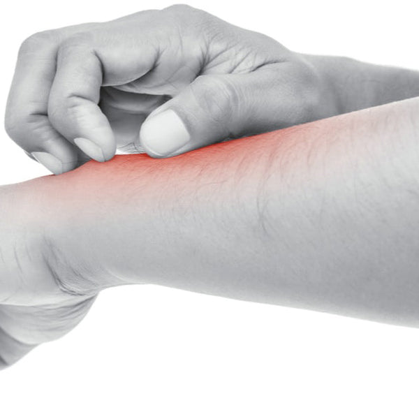 ALL YOU NEED TO KNOW ABOUT CONTACT DERMATITIS