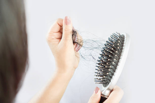 Hair Loss (Alopecia) Treatments