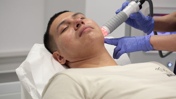 No-Downtime, In-Office Microneedling For Anti-Aging