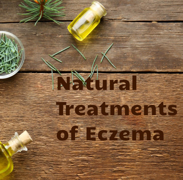 HOW NATURAL TREATMENTS OF ECZEMA GIVES YOU RELIEF?
