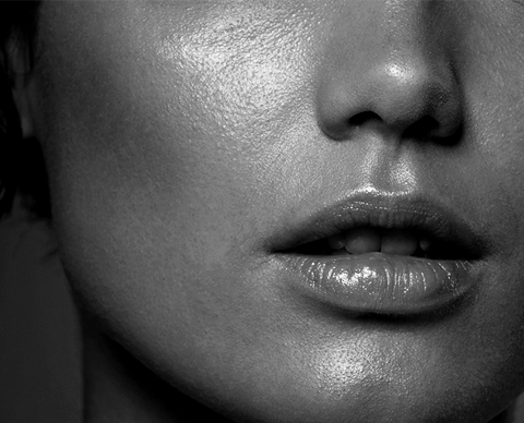 Chemical Peels