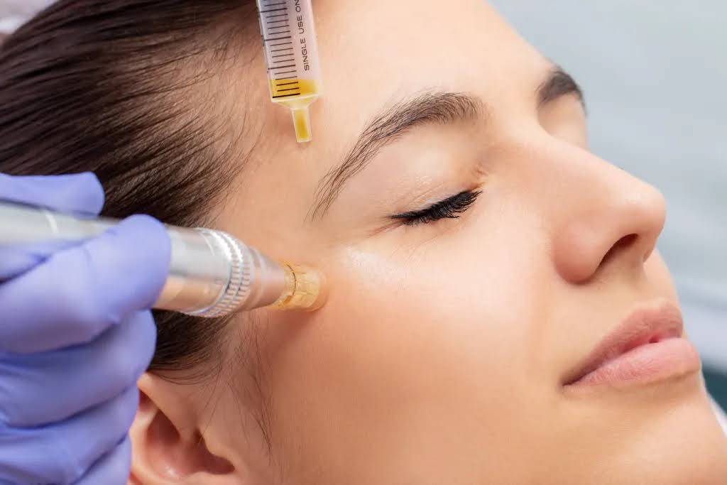 PRF vs PRP: Which Is Best for You?