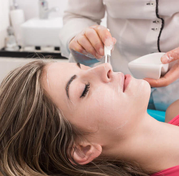 chemical peels