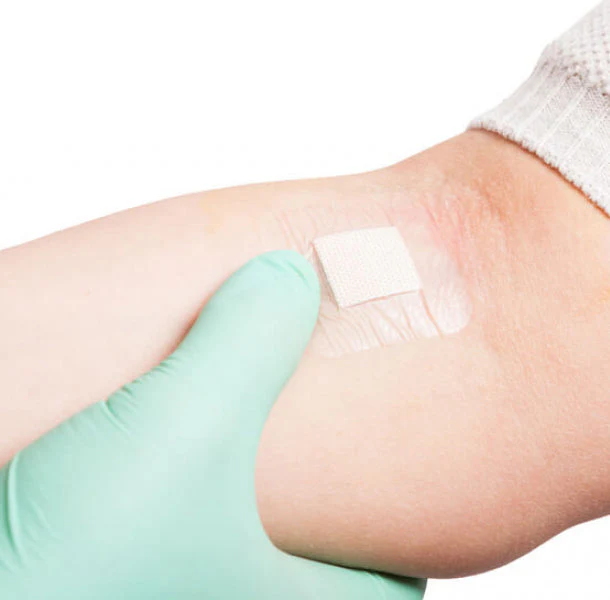 contact dermatitis