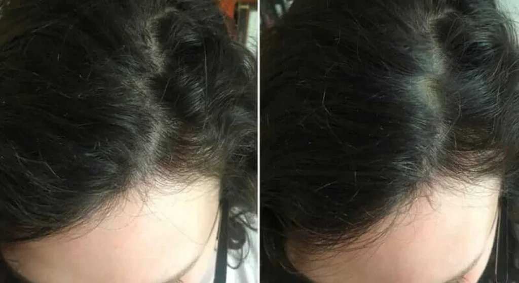 hair