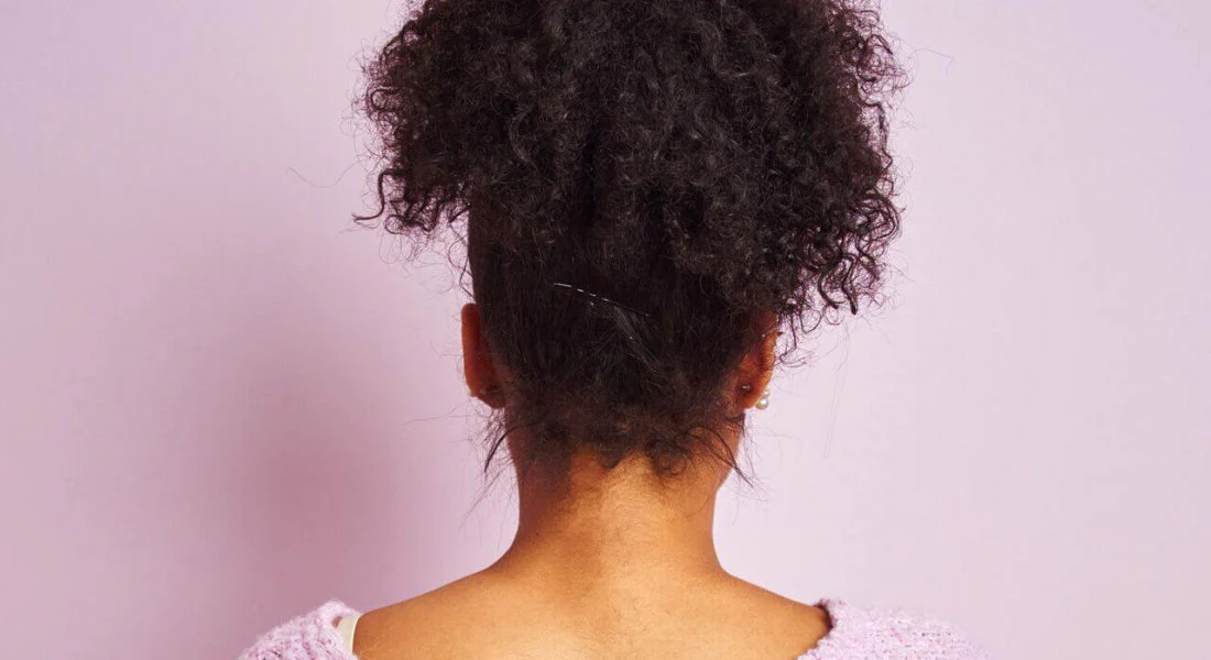 stress-hair-loss