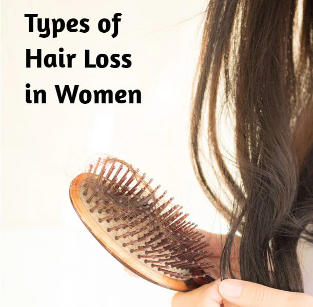 Hair Loss